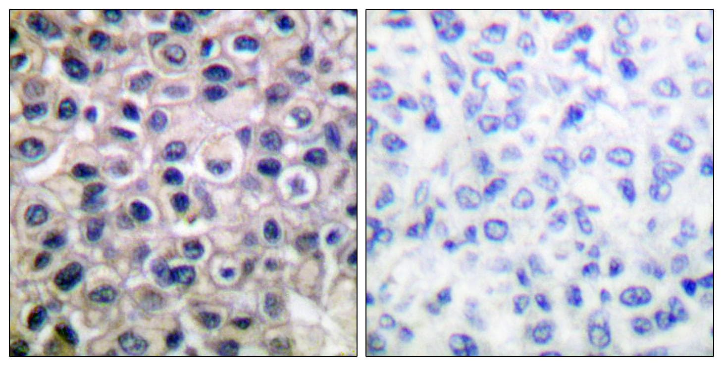 MMP14 Antibody