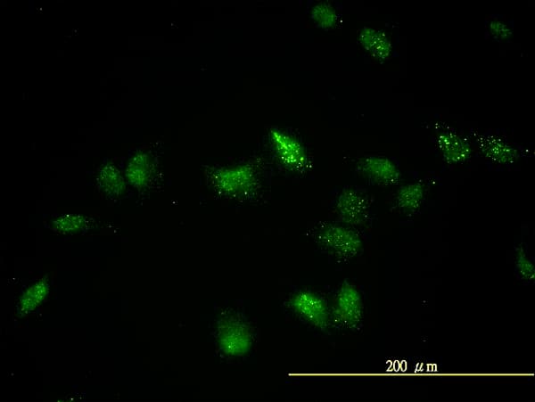 TFEB Antibody (clone S1)