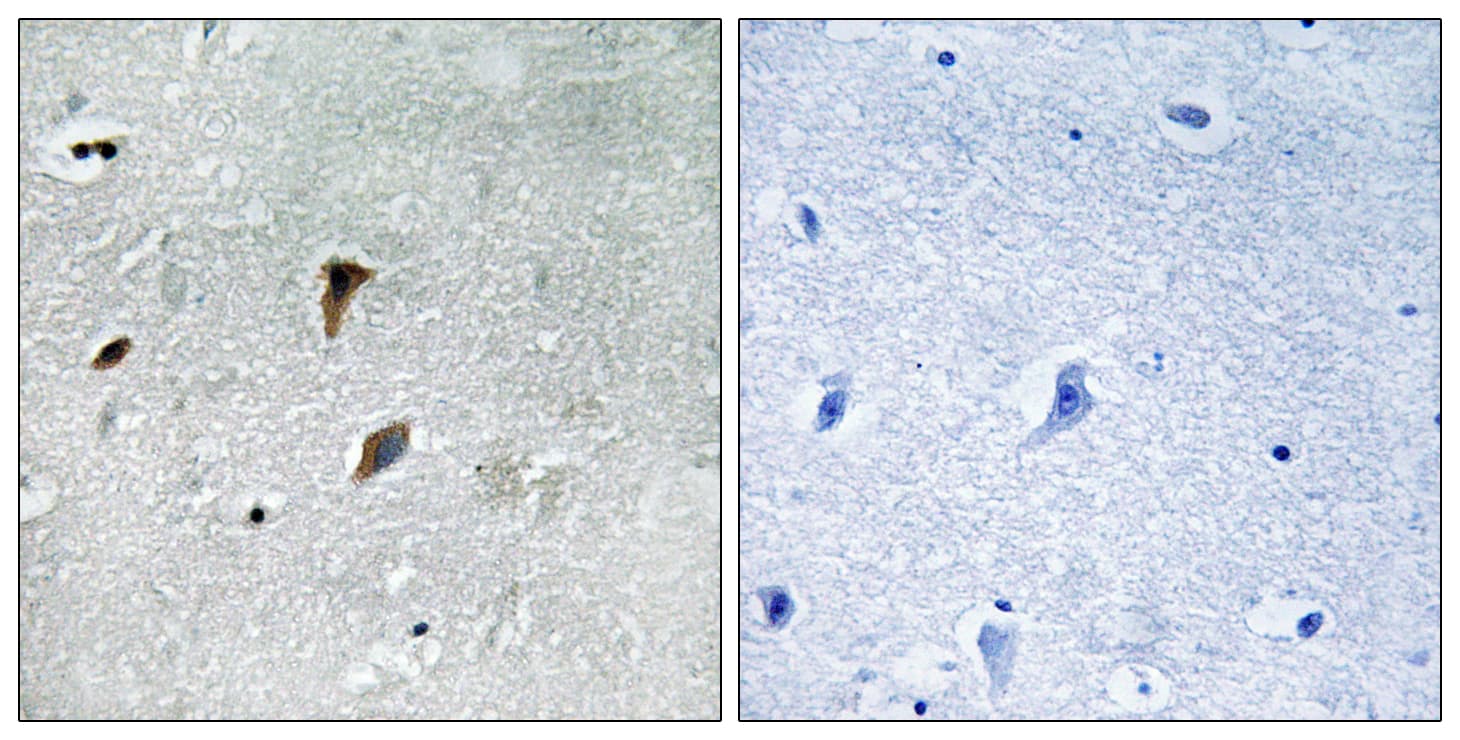 MAP2K3 / MEK3 / MKK3 Antibody (phospho-Thr222)