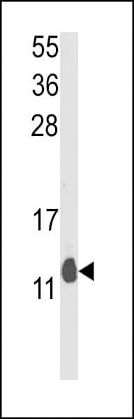 PEA15 / PEA-15 Antibody (aa86-115)