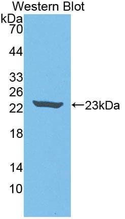PNPLA6 / NTE Antibody (aa965-1137)
