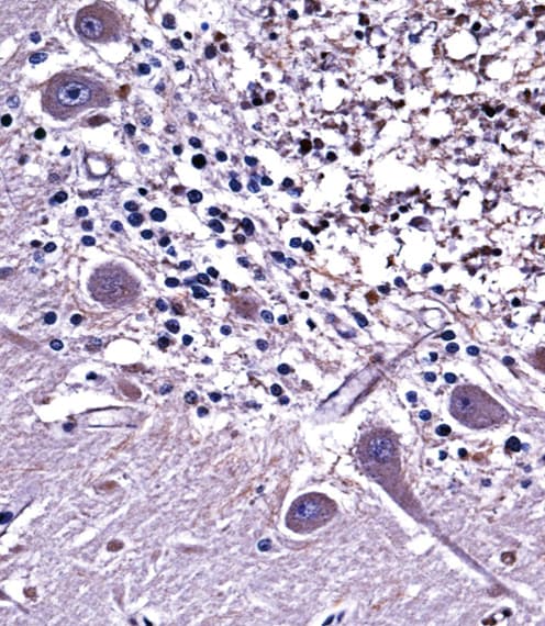 NPPC Antibody (aa80-109)