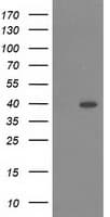 Monoclonal Mouse anti-Human RASSF1 / RASSF1A Antibody (clone OTI3C2, IF, WB)