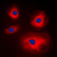 Polyclonal Rabbit anti-Human MRPL11 Antibody (Internal, IHC, IF, WB)