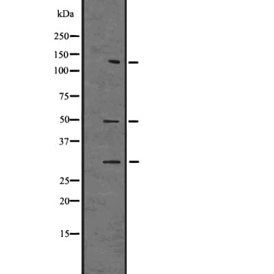 CASP2 / Caspase 2 Antibody