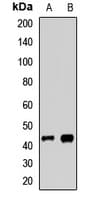 AGER / RAGE Antibody