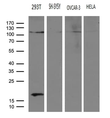 HACE1 Antibody (clone OTI4E10)