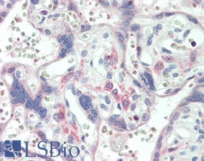 IHC-plus™ AMDHD2 Antibody (aa112-319)