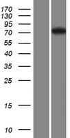 FBXL19 Protein (Over-Expression Lysate Myc-DDK (Flag))