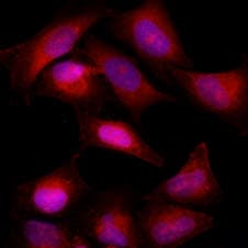 BCL2 / Bcl-2 Antibody (clone AT1B5)