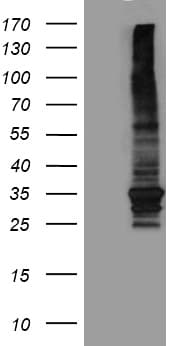 ABCB1 / MDR1 / P Glycoprotein Antibody (aa995-1280, clone OTI9C10)