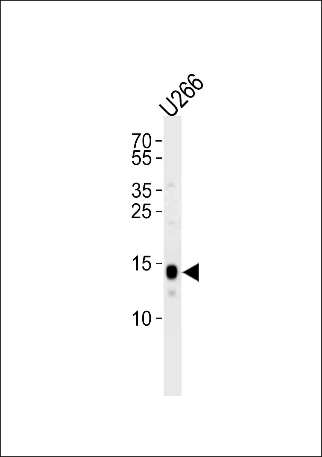 PLN / Phospholamban Antibody (aa1-22)