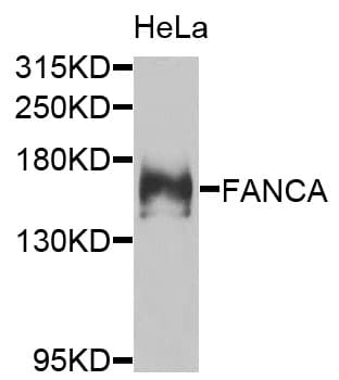 Polyclonal Rabbit anti-Human FANCA Antibody (IHC, WB)