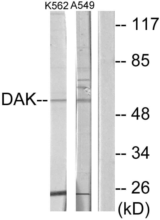 TKFC / DAK Antibody (aa91-140)