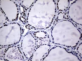 NBN / Nibrin Antibody (clone OTI7D5)