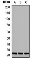 ULK3 Antibody (Internal)