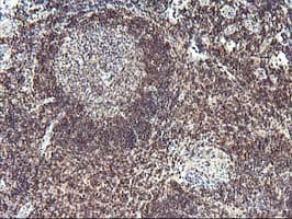PDLIM2 / SLIM Antibody (clone OTI10C4)