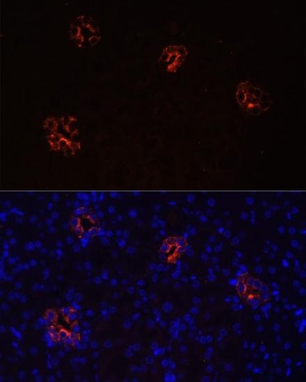 AQP2 / Aquaporin 2 Antibody