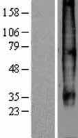 CCR7 Protein (Over-Expression Lysate Myc-DDK (Flag))