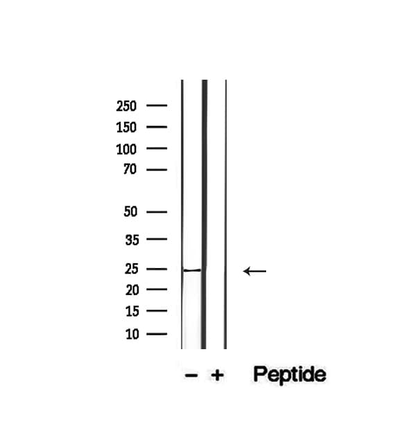 CD28 Antibody