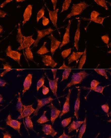 XPNPEP3 Antibody