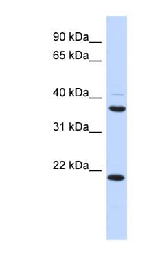 Polyclonal Rabbit anti-Human TMEM74 Antibody (aa215-264, WB)