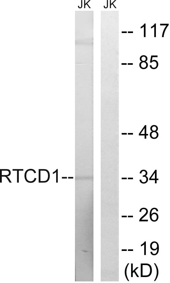 Polyclonal Rabbit anti-Human RTCD1 / RPC Antibody (aa317-366, IHC, WB)