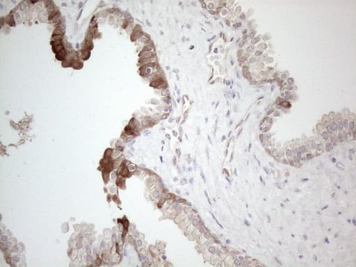 CAMK2B / CaMKII Beta Antibody (aa311-385, clone OTI8D9)