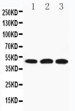 HYAL3 Antibody (aa357-371)