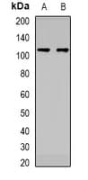 Polyclonal Rabbit anti-Human DDX11 / CHLR1 Antibody (WB)