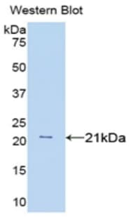 TNF Alpha Antibody (aa80-235)