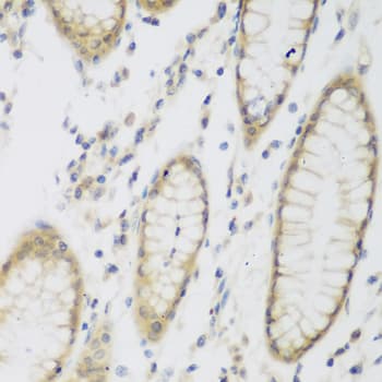 Polyclonal Rabbit anti-Human NAT8B Antibody (IHC, IF, WB)