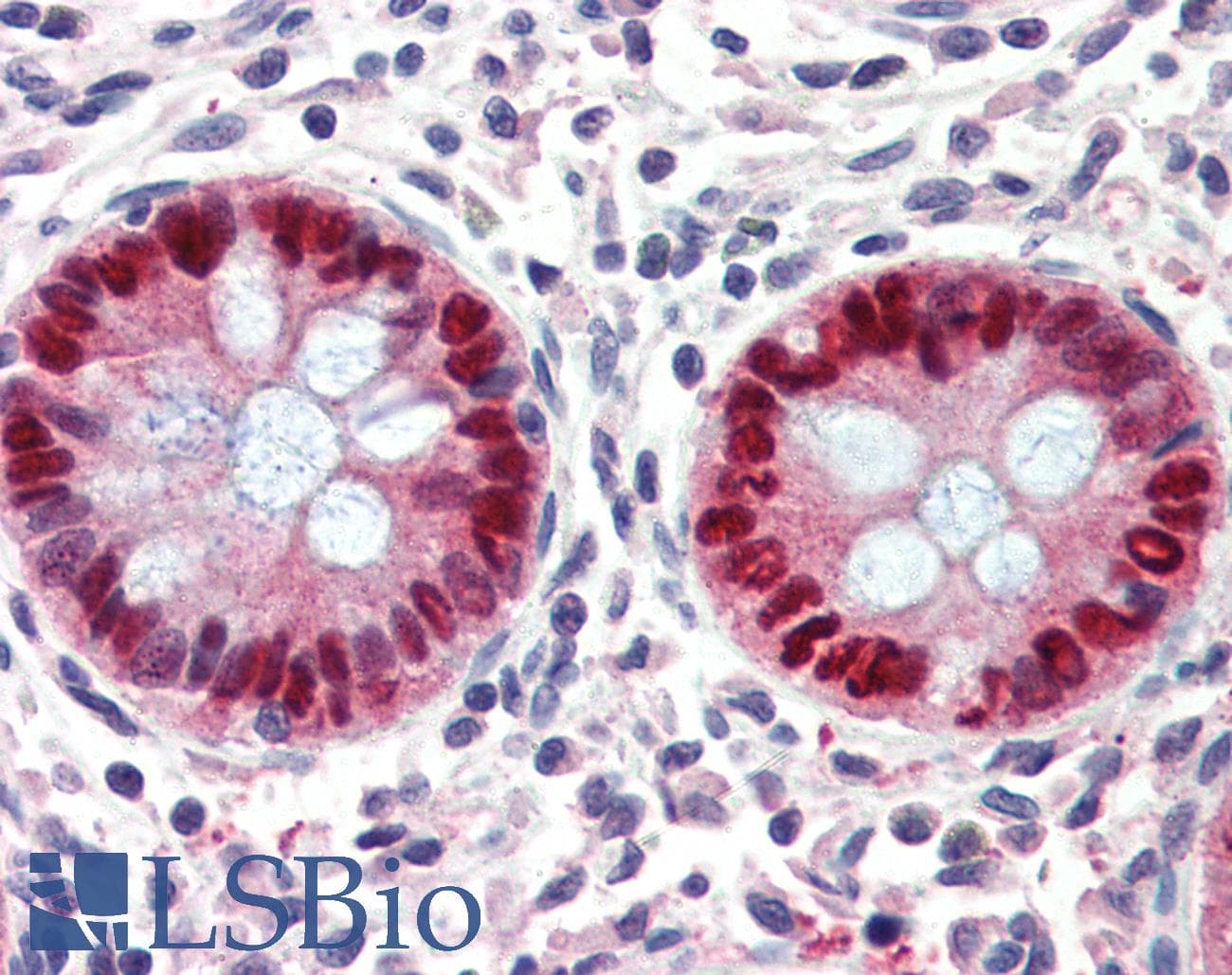 PathPlus™ Polyclonal Goat anti-Human EGR2 Antibody (aa239-251, IHC, WB)