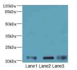VPS25 Antibody