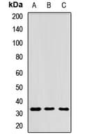 Polyclonal Rabbit anti-Human RPIA / RPI Antibody (WB)