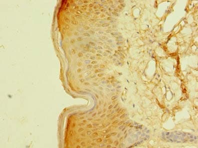 Polyclonal Rabbit anti-Human PSMD7 / MOV34 Antibody (IHC, WB)