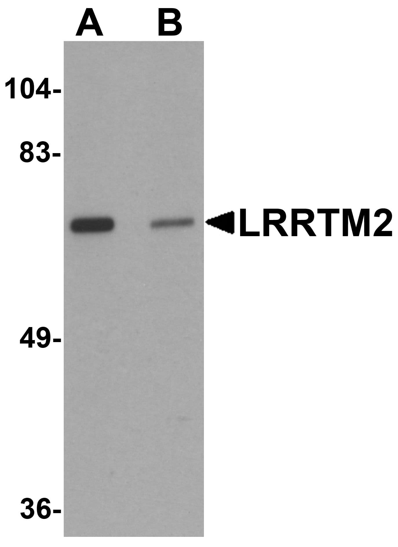 IHC-plus™ LRRTM2 Antibody
