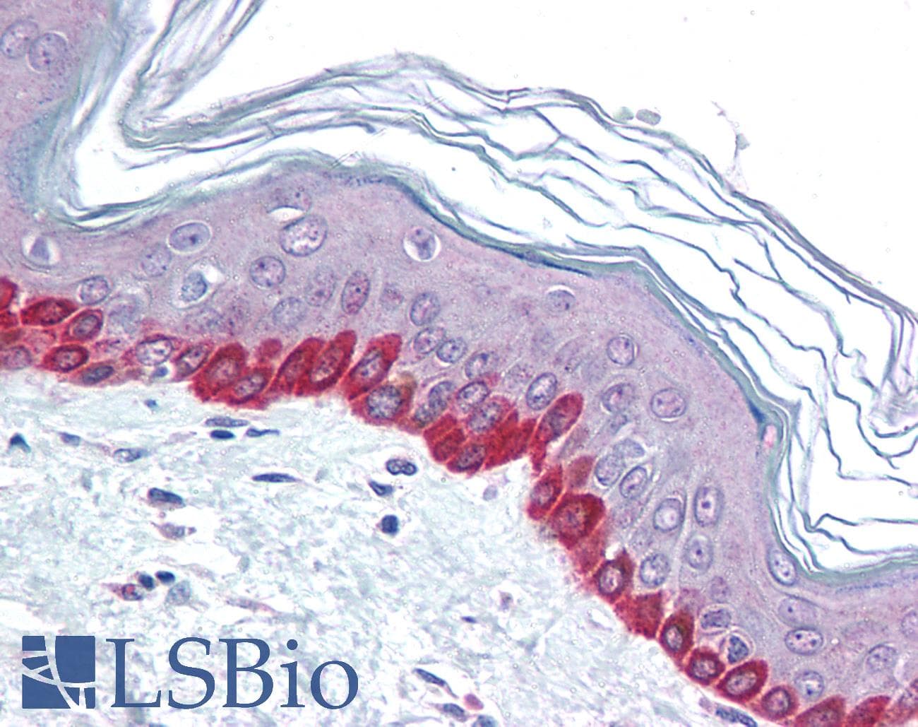 IHC-plus™ STEAP2 Antibody