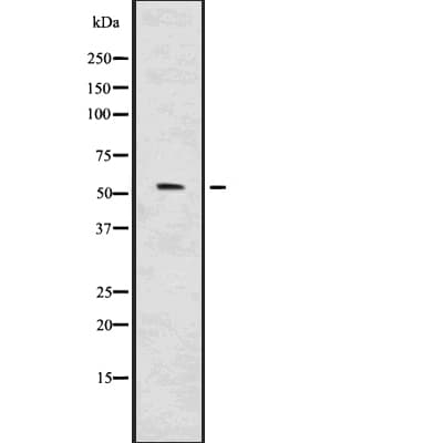 Polyclonal Rabbit anti-Human IRF7 Antibody (IHC, WB)