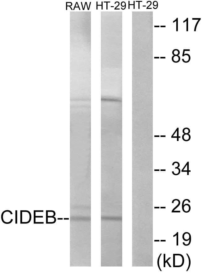 CIDEB Antibody (aa91-140)