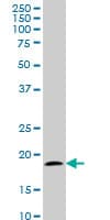 IHC-plus™ TOMM22 / TOM22 Antibody (clone 4G4)
