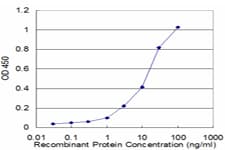 Monoclonal Mouse anti-Human PRKAB1 / AMPK Beta 1 Antibody (clone 3H12-1A10, WB)
