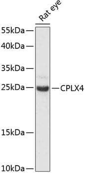 CPLX4 / Complexin IV Antibody