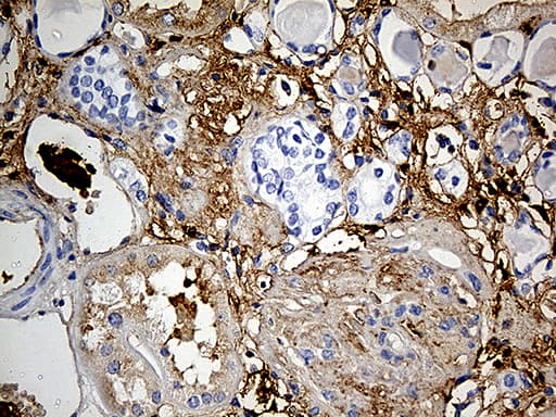 PLG / Plasmin / Plasminogen Antibody (aa301-586, clone OTI4F5)