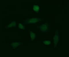 IHC-plus™ GLB1 / Beta-Galactosidase Antibody (clone 10B2)