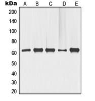 Polyclonal Rabbit anti-Human TP63 / p63 Antibody (N-Terminus, WB)