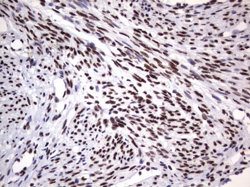 DDX56 Antibody (aa323-547, clone UMAB153, Carrier-free)