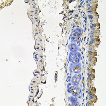 NDUFA6 Antibody