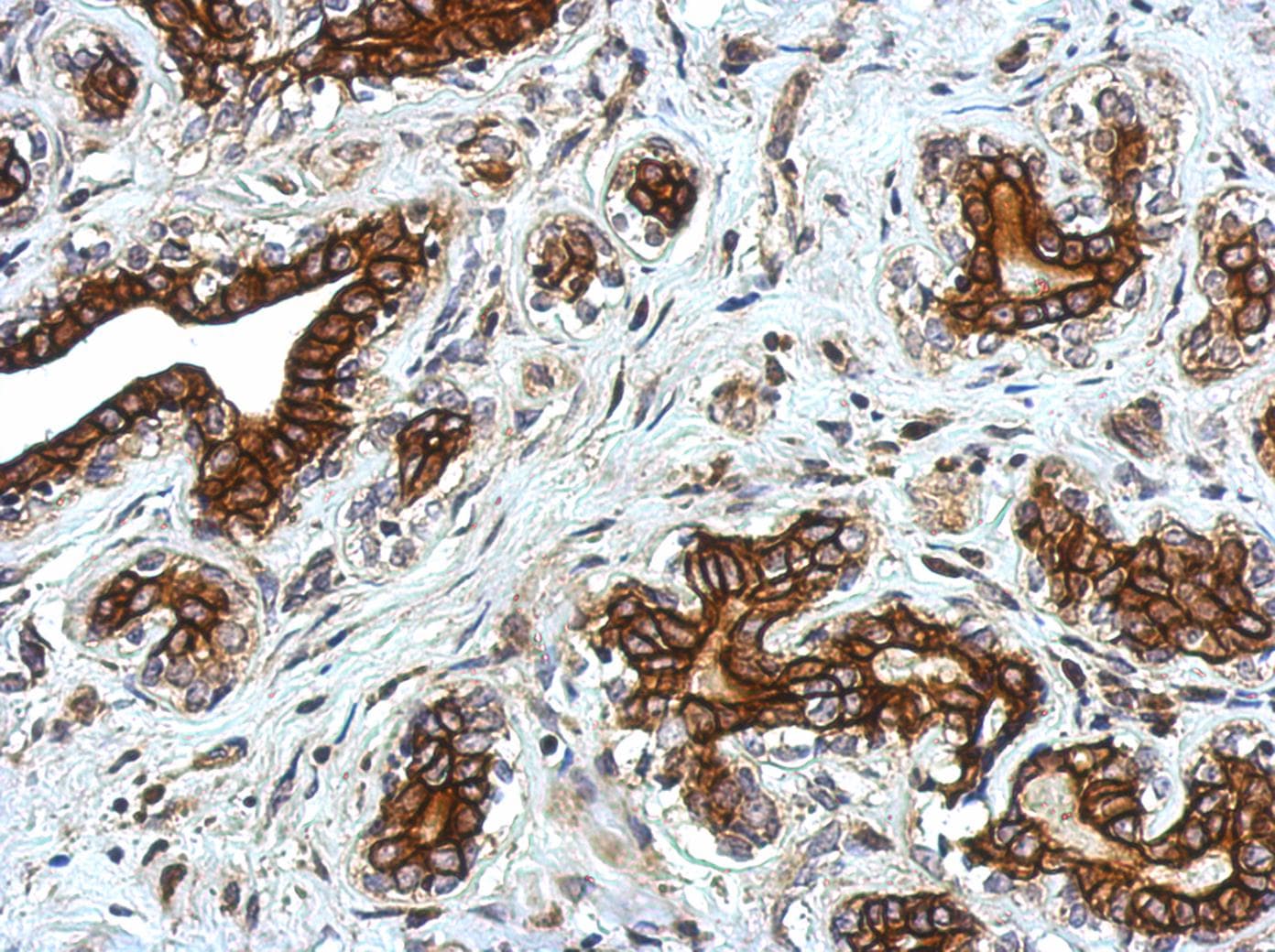 GLRA2 Antibody (aa1-216)