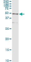 IHC-plus™ CTSD / Cathepsin D Antibody (clone 3F12-1B9)
